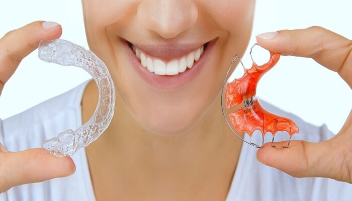 retainers and Invisalign