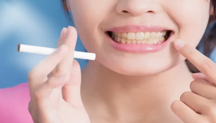 tobacco stains on teeth